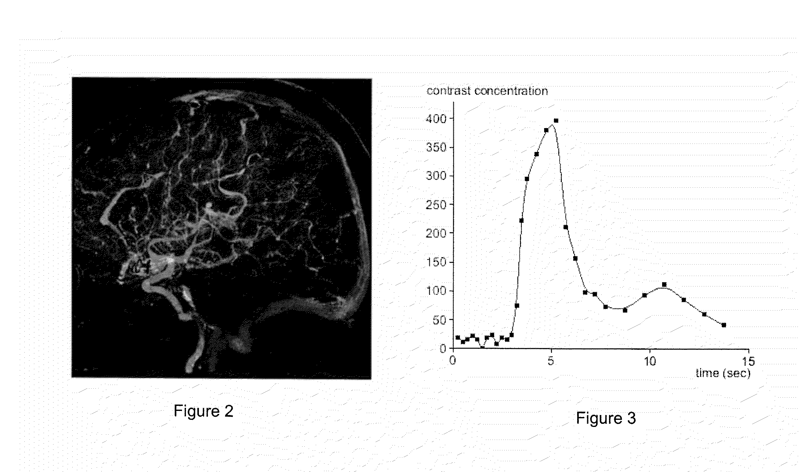 System for Processing Medical Image data to Provide Vascular Function Information