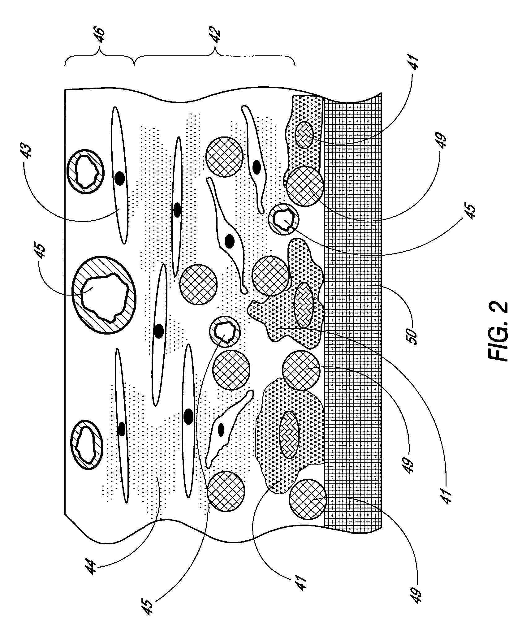 Analyte sensing biointerface