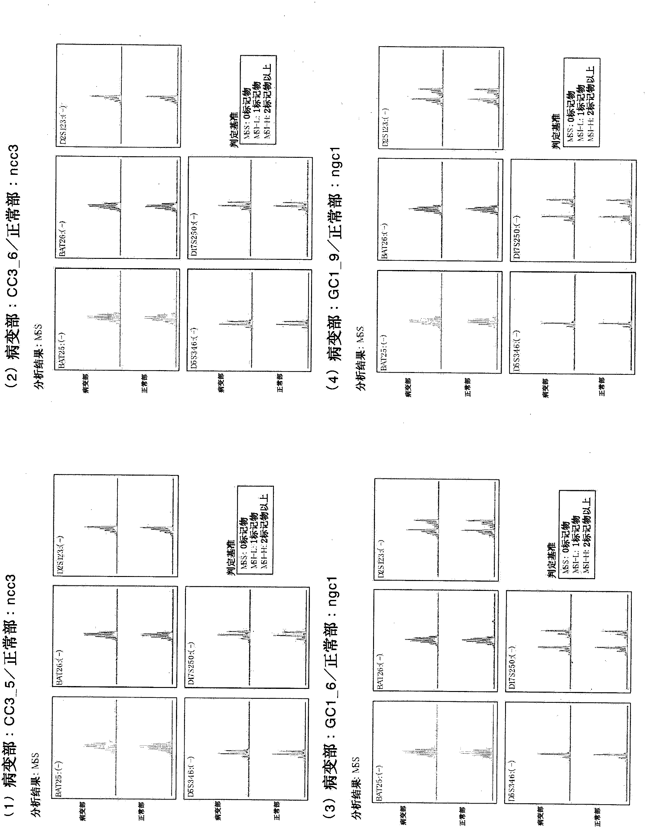 Induced malignant stem cells