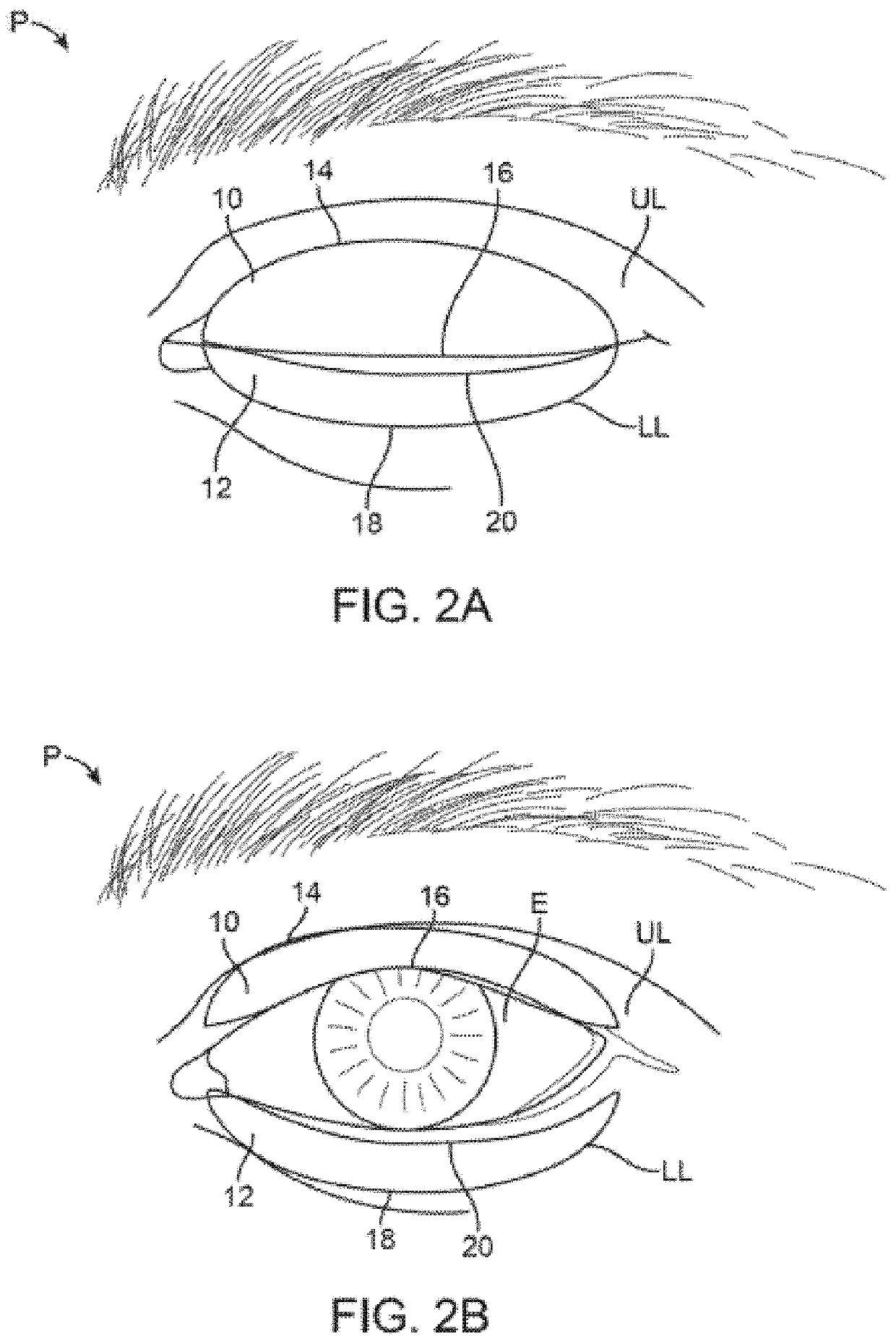 Treatment apparatus and methods