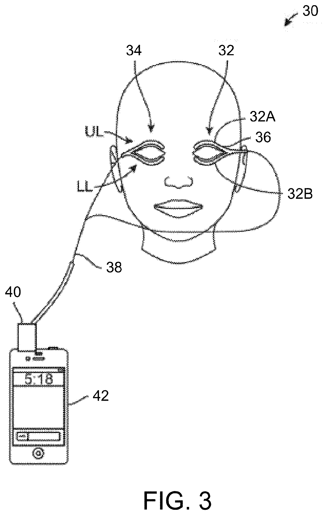 Treatment apparatus and methods