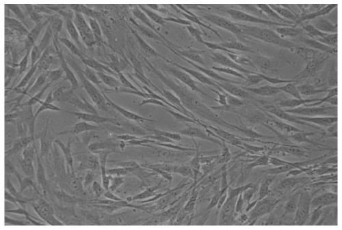 Culture and cryopreservation method of amniotic mesenchymal stem cells