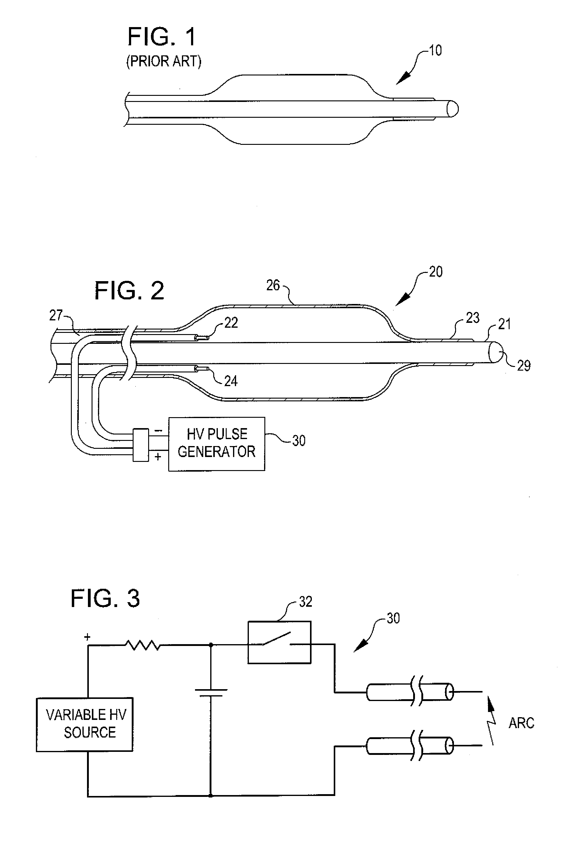 Drug delivery shockwave balloon catheter system