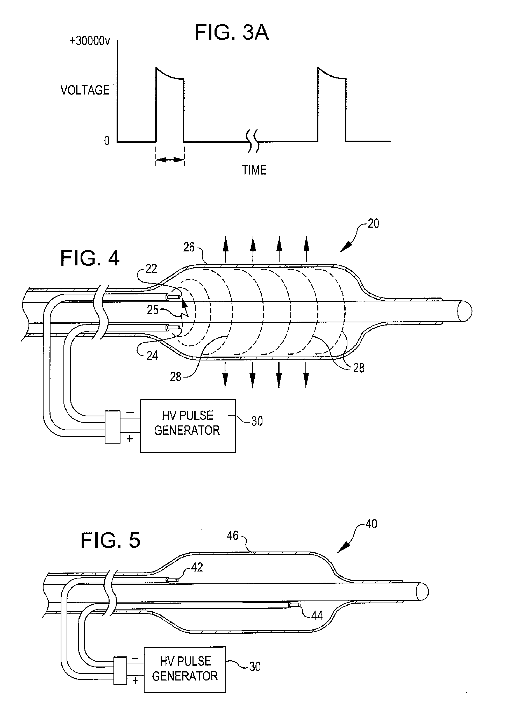 Drug delivery shockwave balloon catheter system