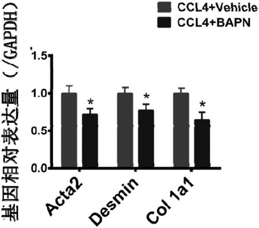 Use of aminopropionitrile in preparation of medicine