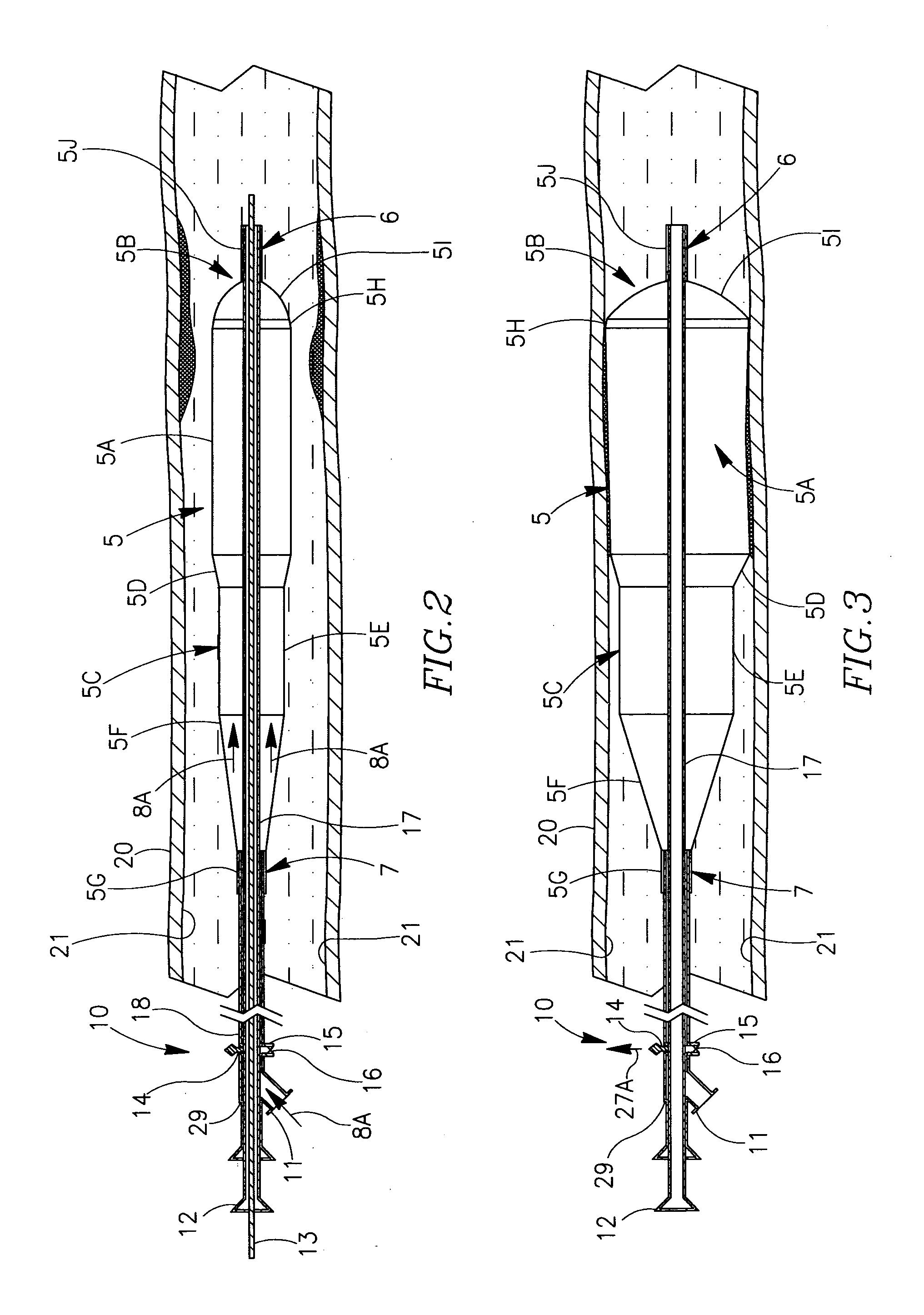 Balloon catheter system and methods of use thereof