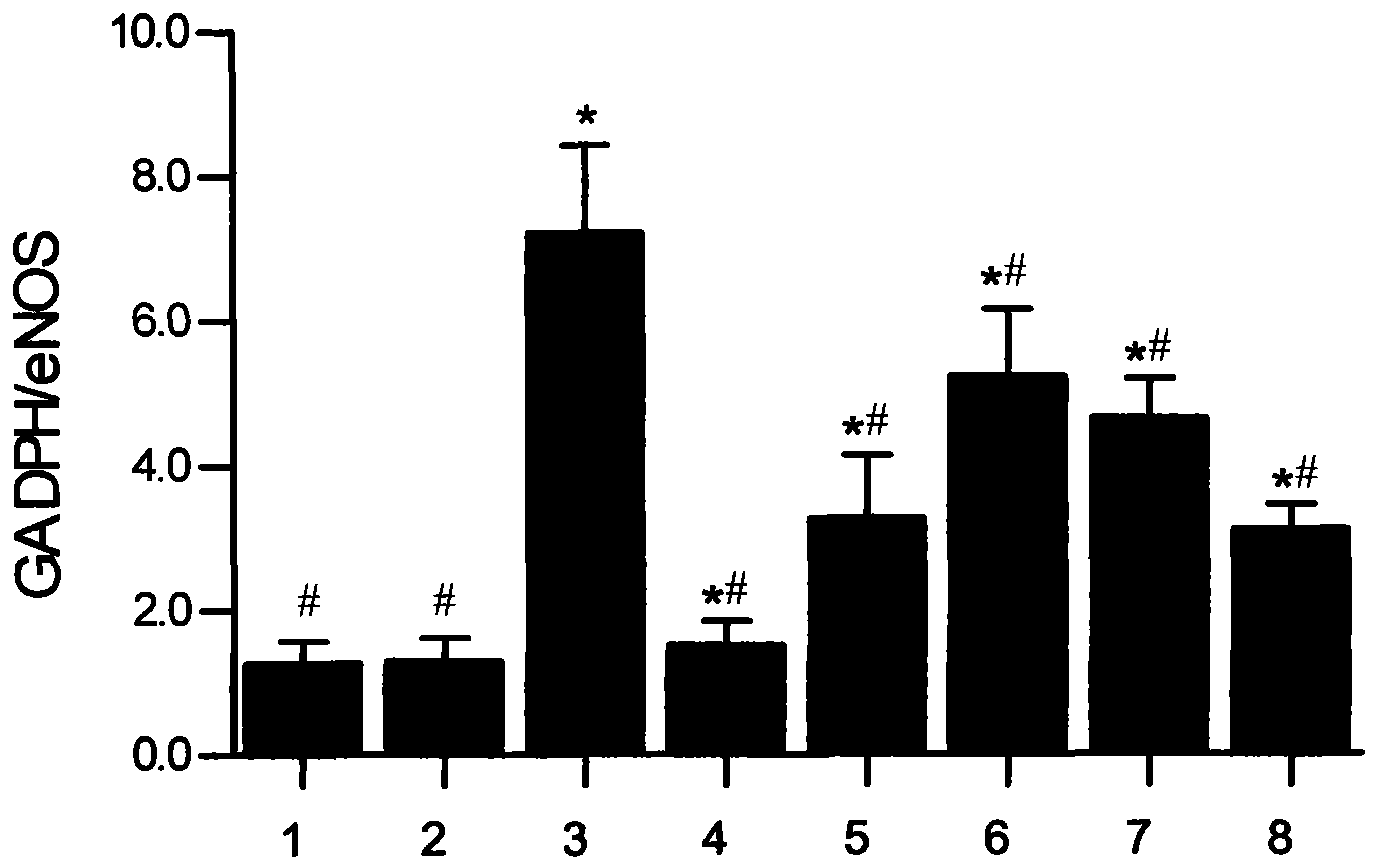 Medicinal composition for treating essential hypertension and application thereof