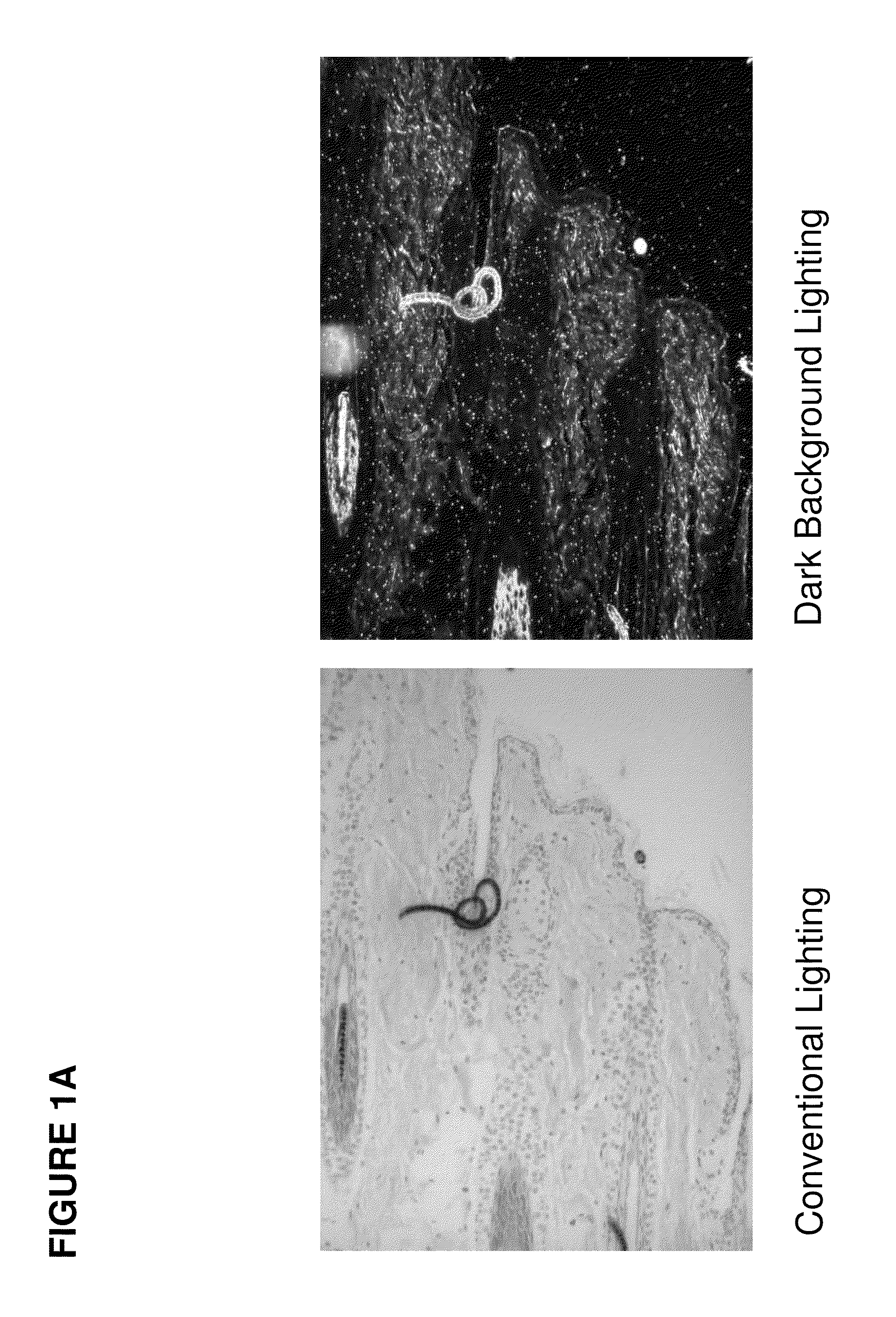 Modulators of ELOVL5 for treating acne or hyperseborrhea