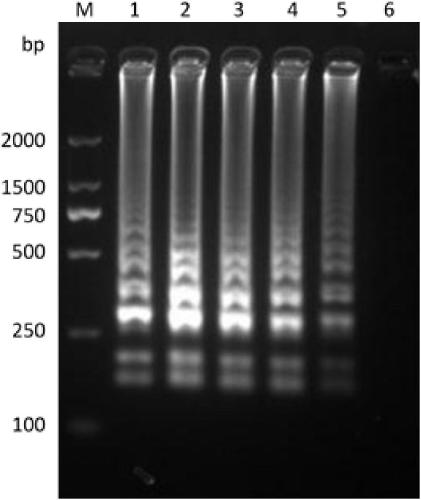 LAMP detection kit and detection primers for pathogenic bacteria of bacterial mumps of pelodiscus sinensis