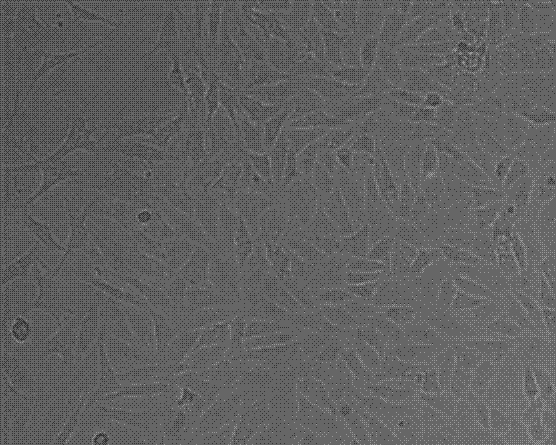 A method for separating and culturing rabbit adipose stem cells