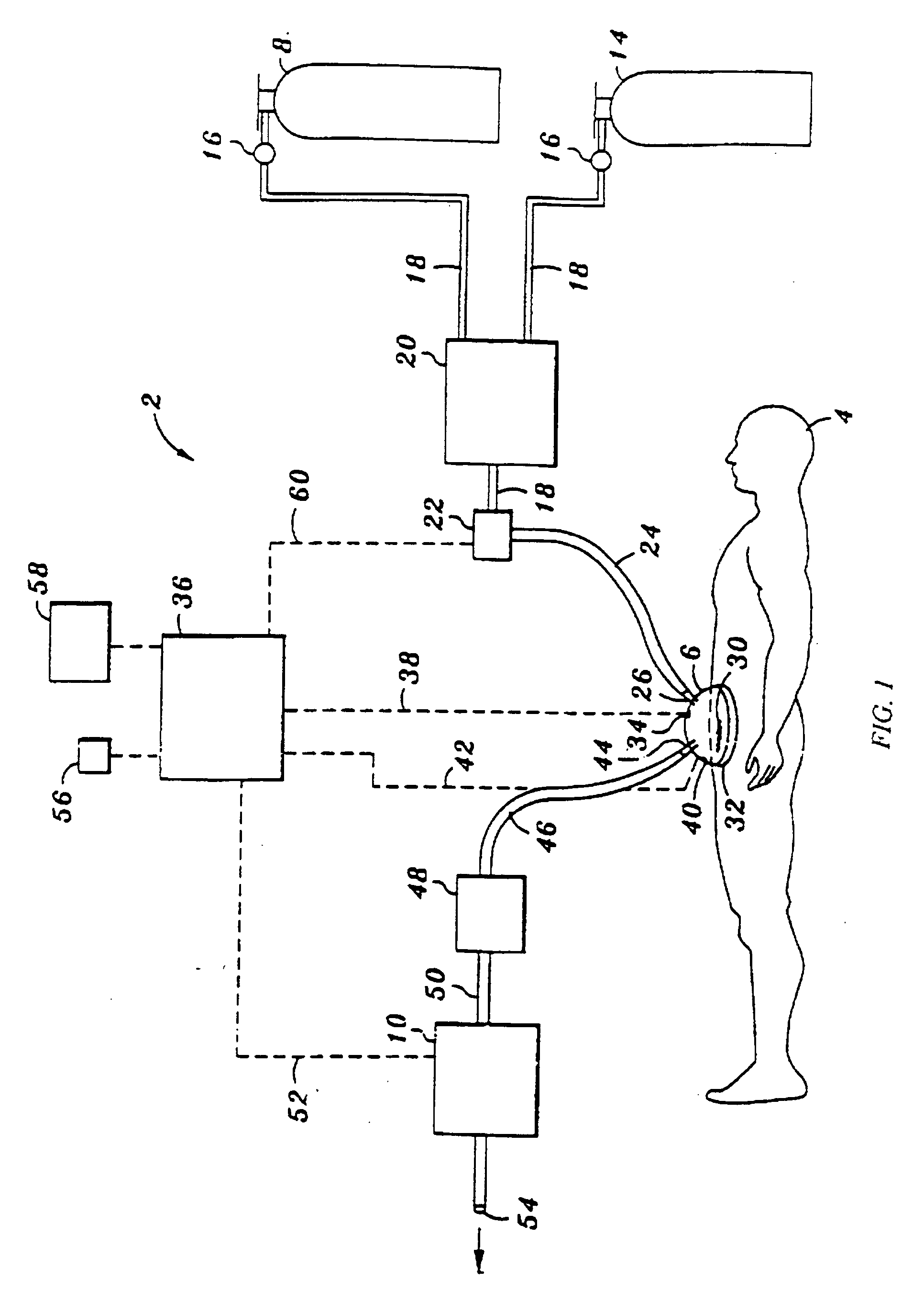 Device and method for treatment of wounds with nitric oxide