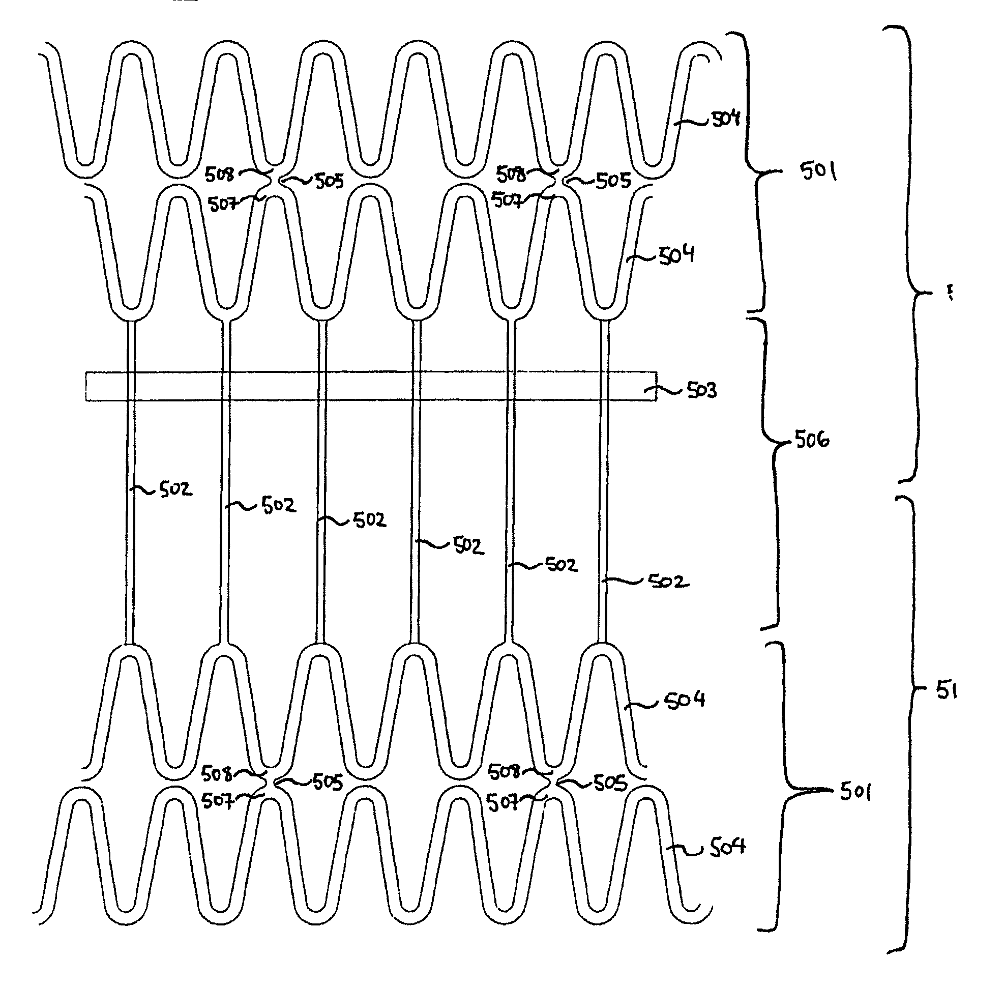 Tubular supporting prosthesis with a heart valve, in particular for aortic valve replacement