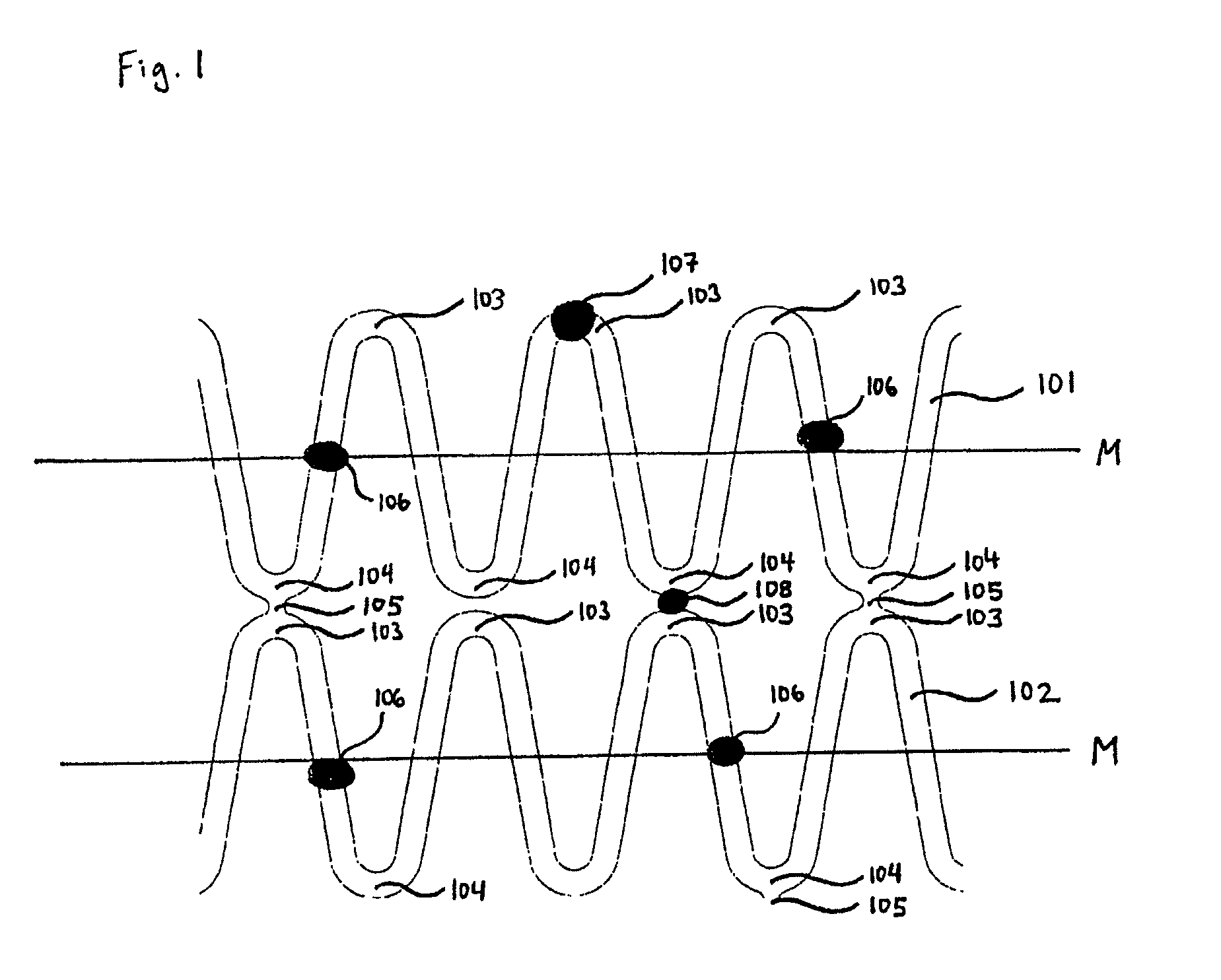 Tubular supporting prosthesis with a heart valve, in particular for aortic valve replacement