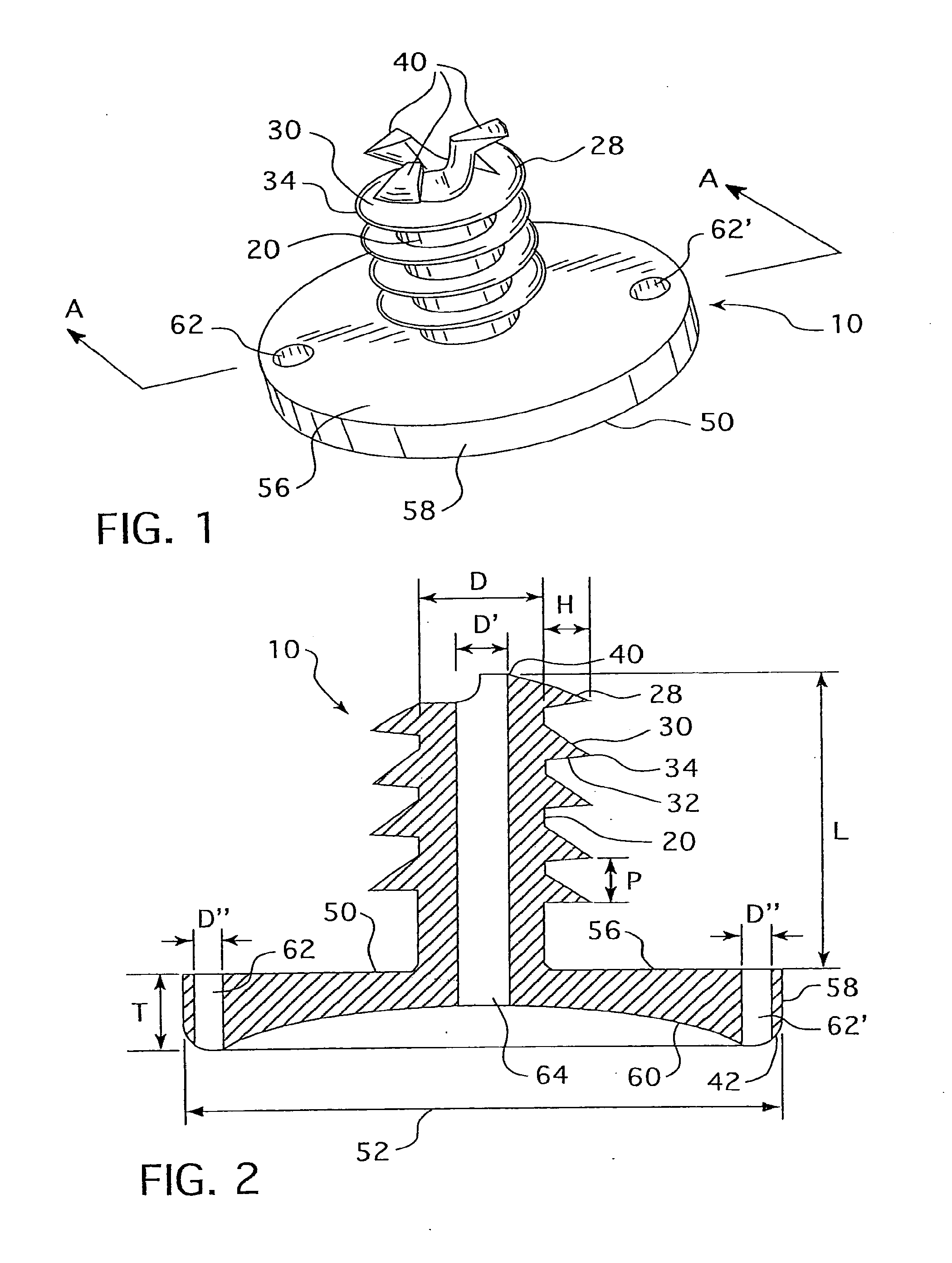 Cannulated Hemi-Implant and Methods of Use Thereof