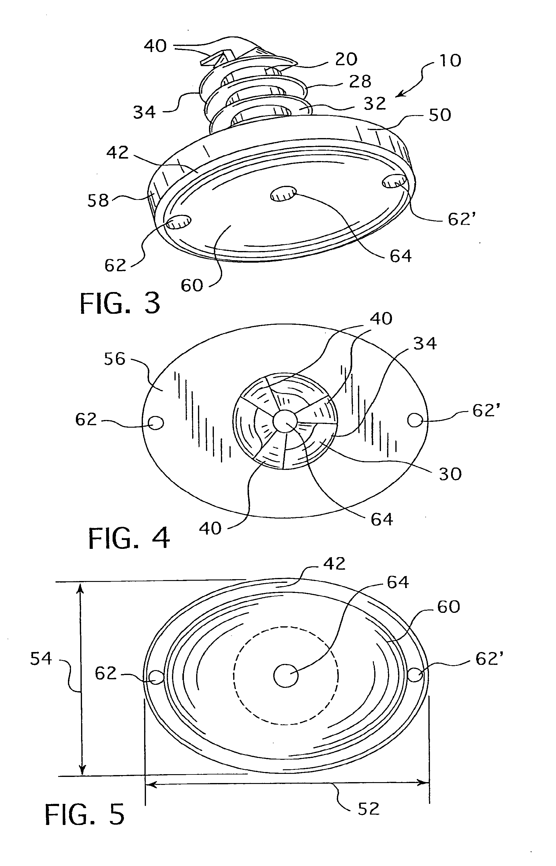 Cannulated Hemi-Implant and Methods of Use Thereof