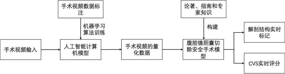 Intelligent auxiliary method and system for improving safety of laparoscopic cholecystectomy