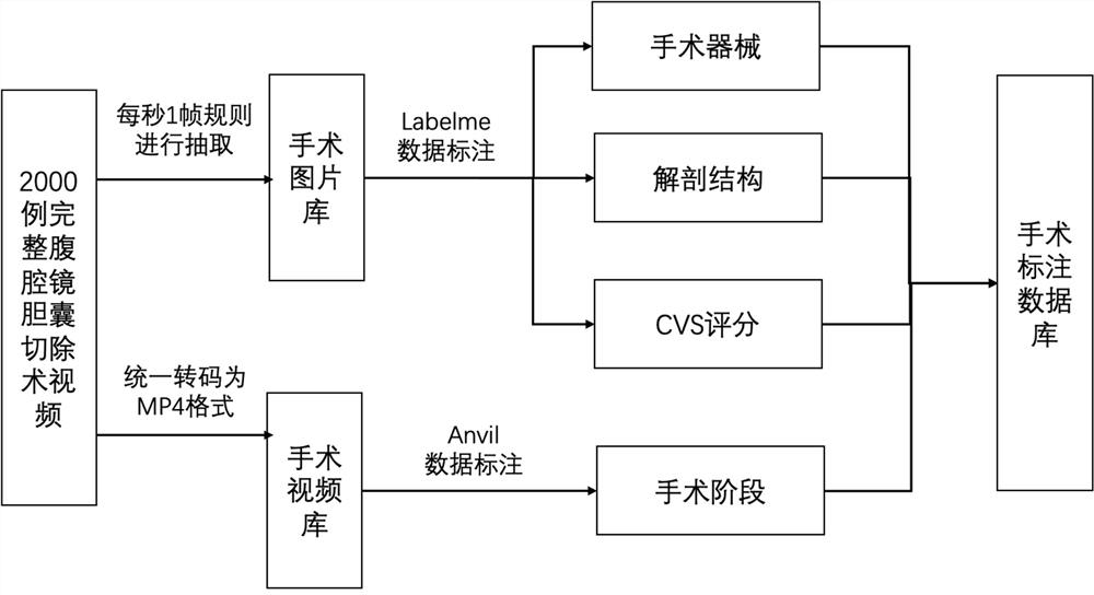 Intelligent auxiliary method and system for improving safety of laparoscopic cholecystectomy