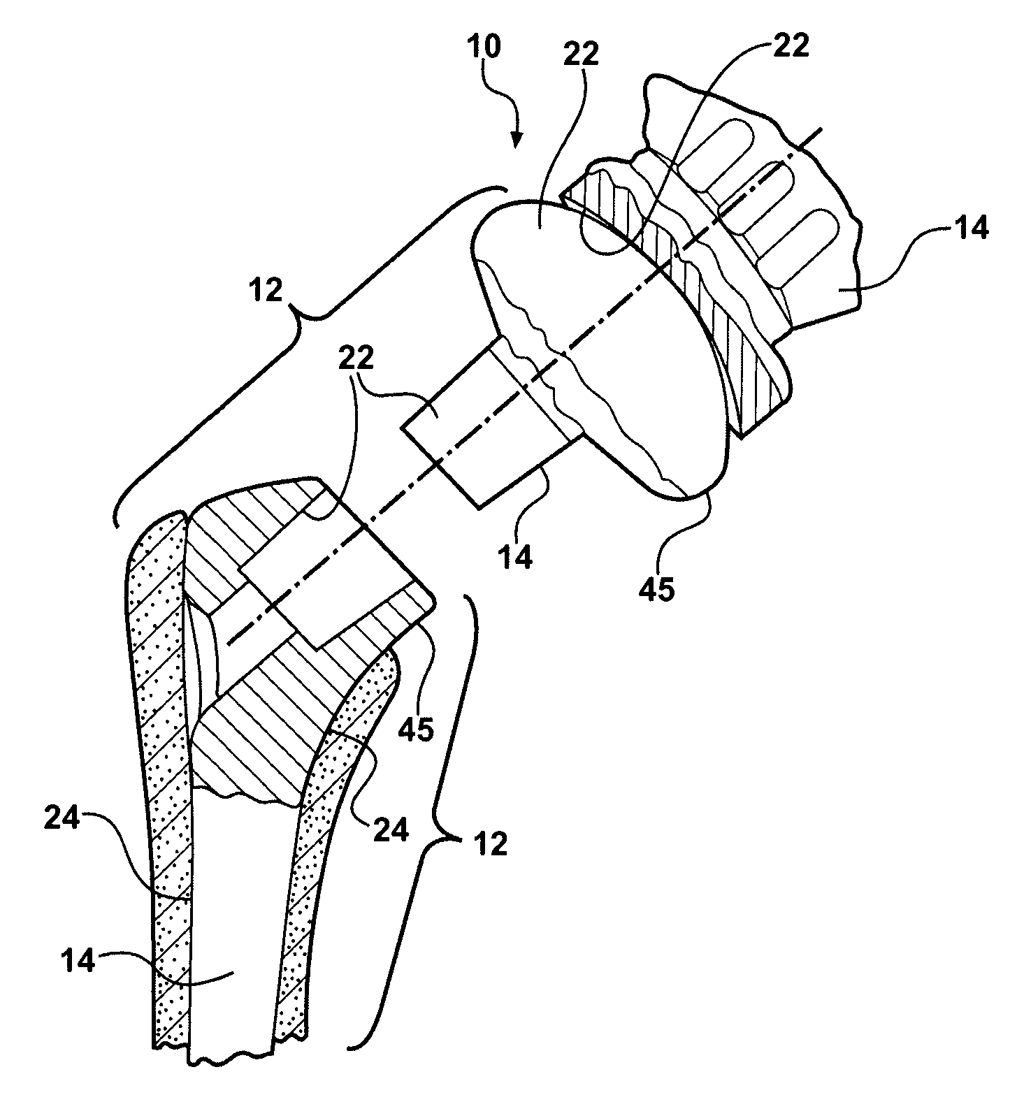 Tetrahedral Amorphous Carbon Coated Medical Devices