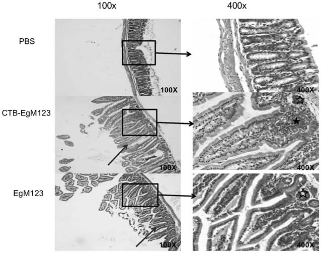 Vaccine to block transmission of echinococcosis pathogen Echinococcus granulosus at source