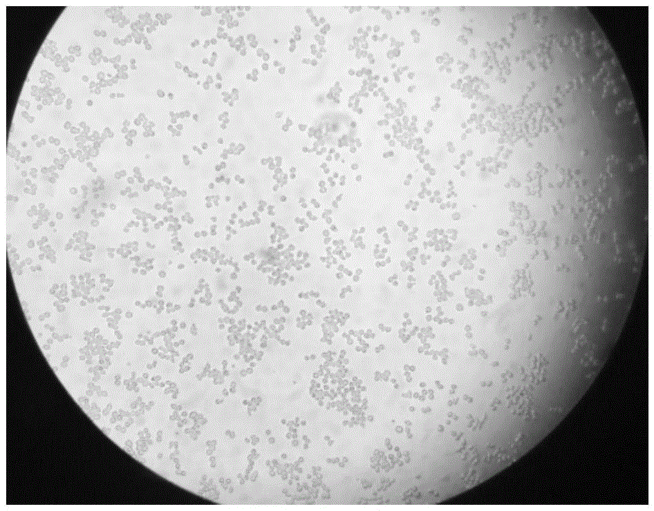 Method for preparing antibodies from human peripheral blood memory B lymphocytes