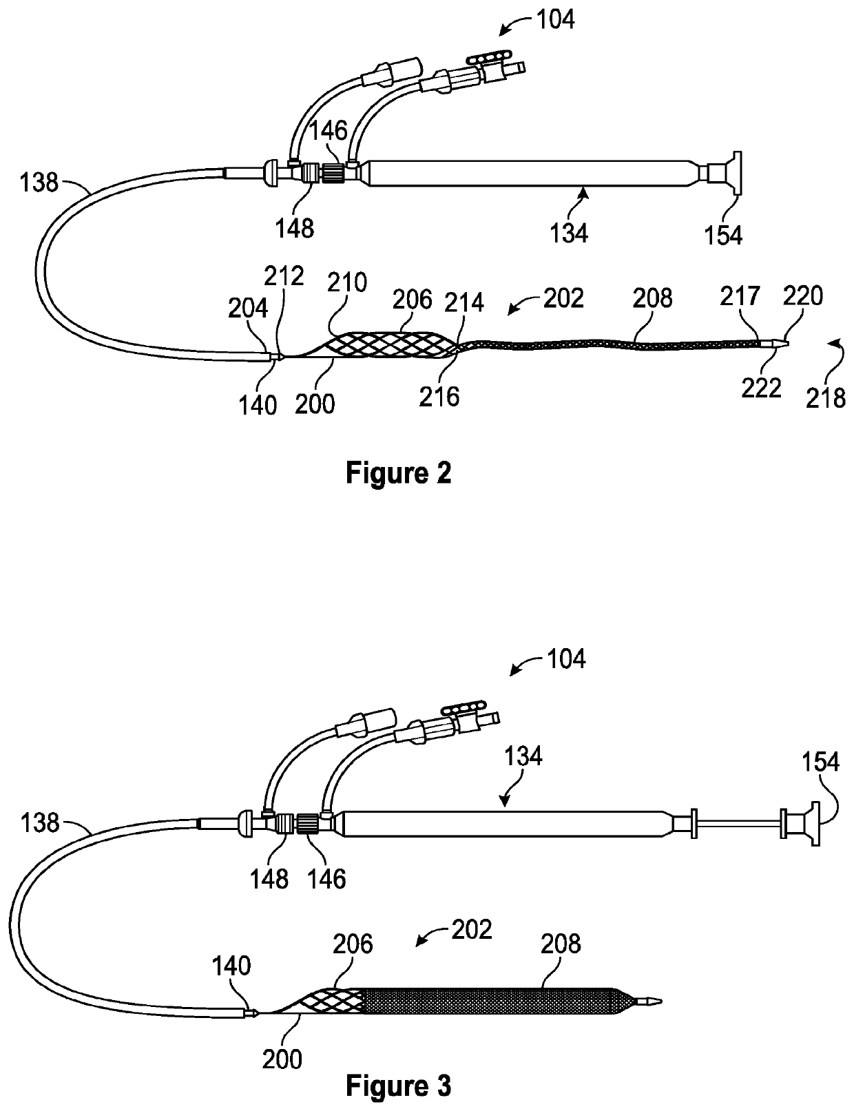 Intravascular treatment of vascular occlusion and associated devices, systems, and methods