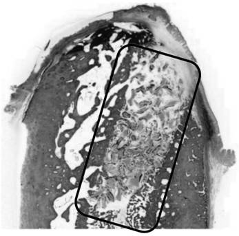 Bone induction regeneration membrane as well as preparation method and application thereof