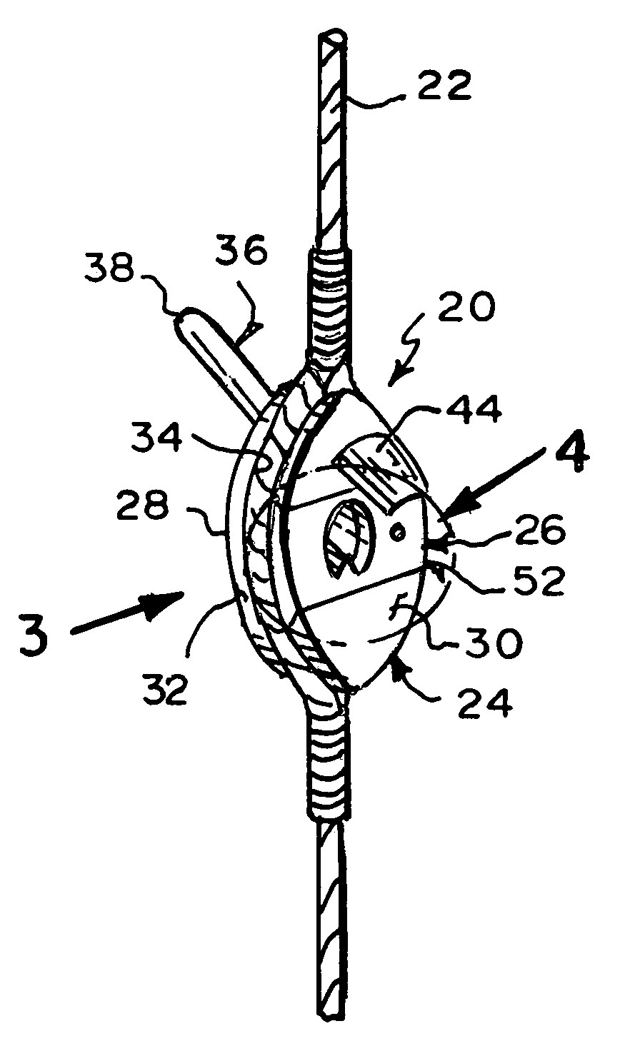 Rear peep sight for mounting to a bow string, having interchangeable sight ports for accommodating user preferences