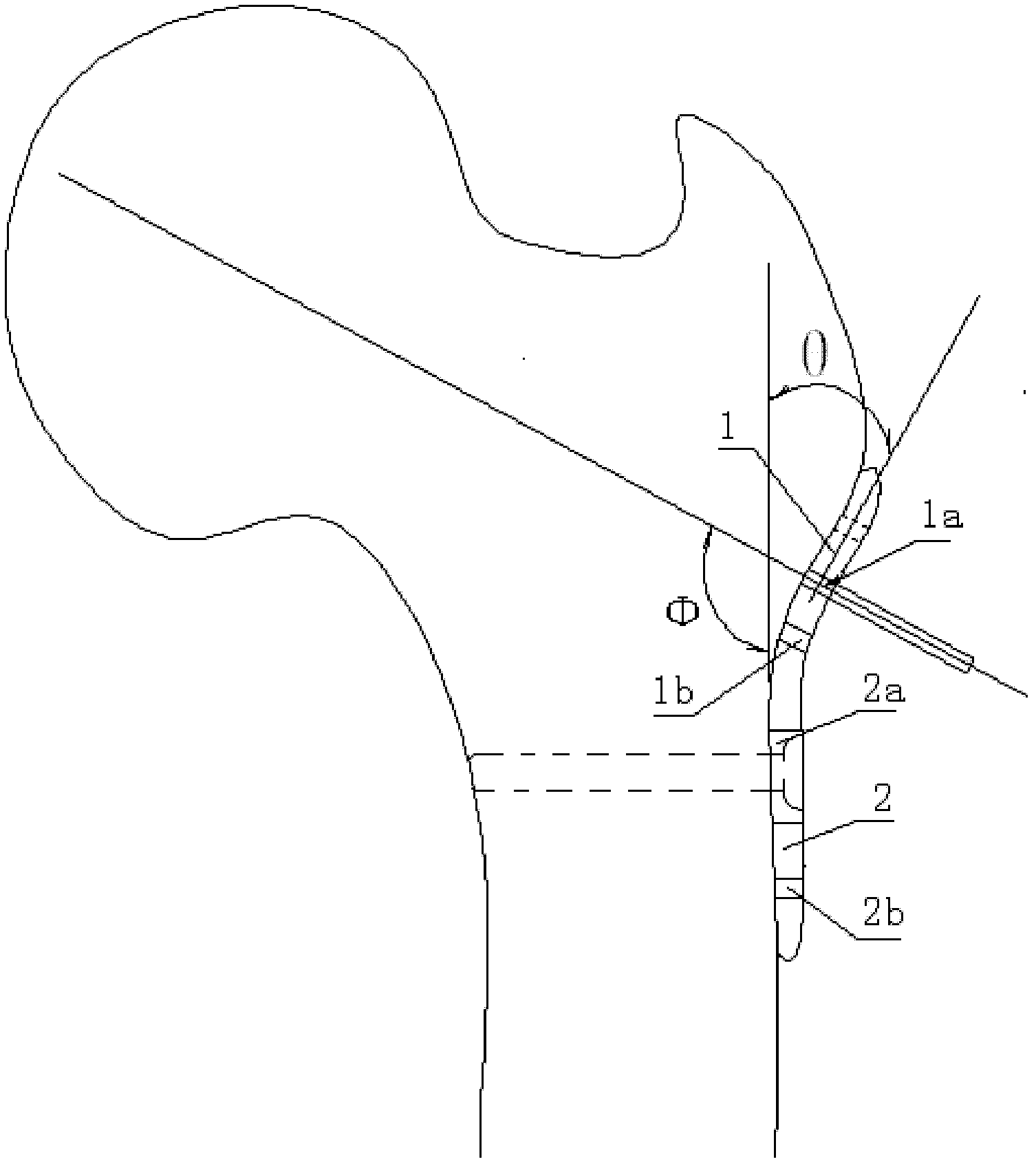 Positioning board for treating fracture of femur neck