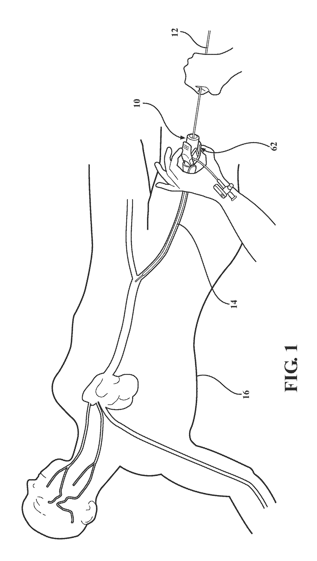 Medical valve with a variable diameter seal