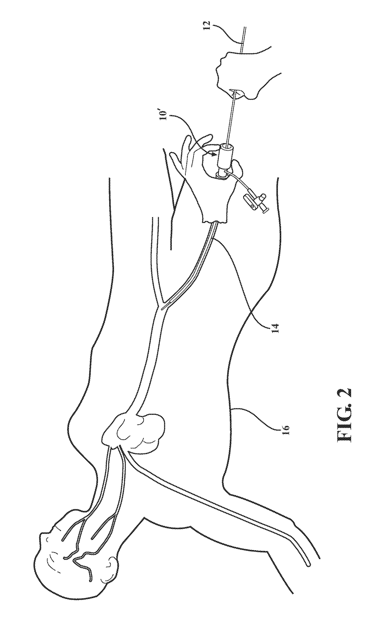 Medical valve with a variable diameter seal