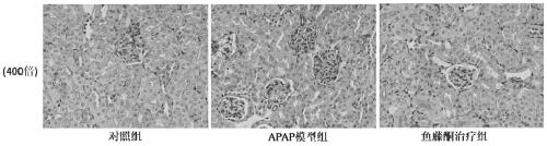 Use of rotenone for the preparation of acute kidney injury