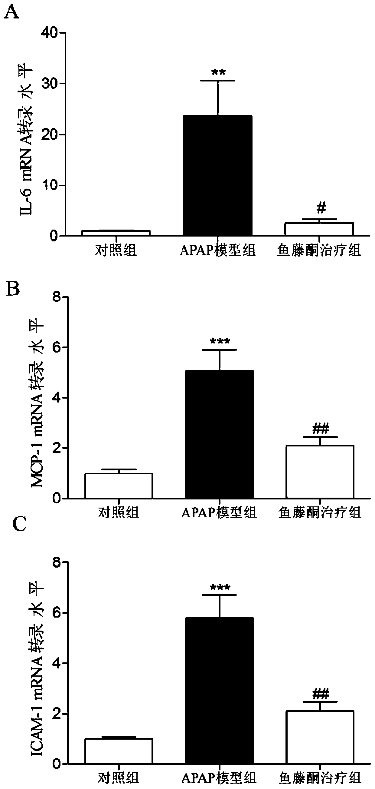 Use of rotenone for the preparation of acute kidney injury