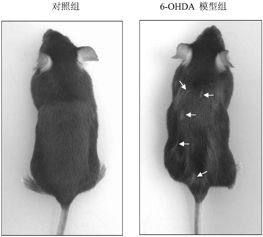 Application of 6-hydroxy dopamine (6-OHDA) to building of depigmentation model and method