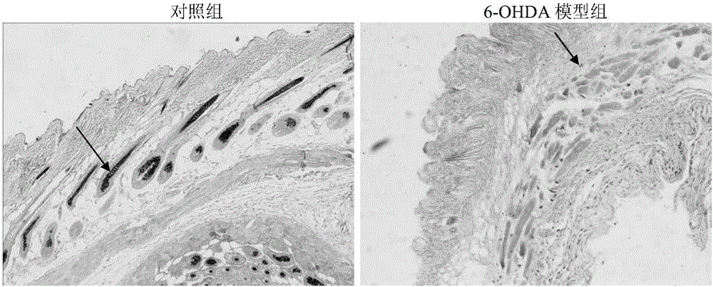 Application of 6-hydroxy dopamine (6-OHDA) to building of depigmentation model and method