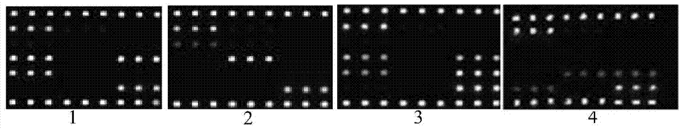 Gene chip, kit and method for detecting three viruses for immunosuppression disease of chickens