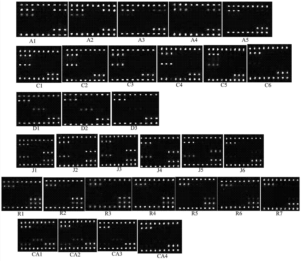 Gene chip, kit and method for detecting three viruses for immunosuppression disease of chickens