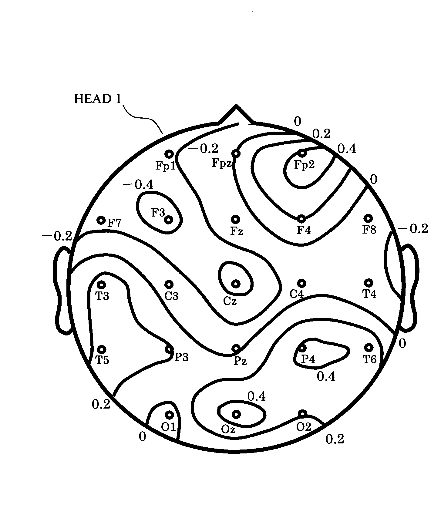 Apparatus for measuring brain local activity