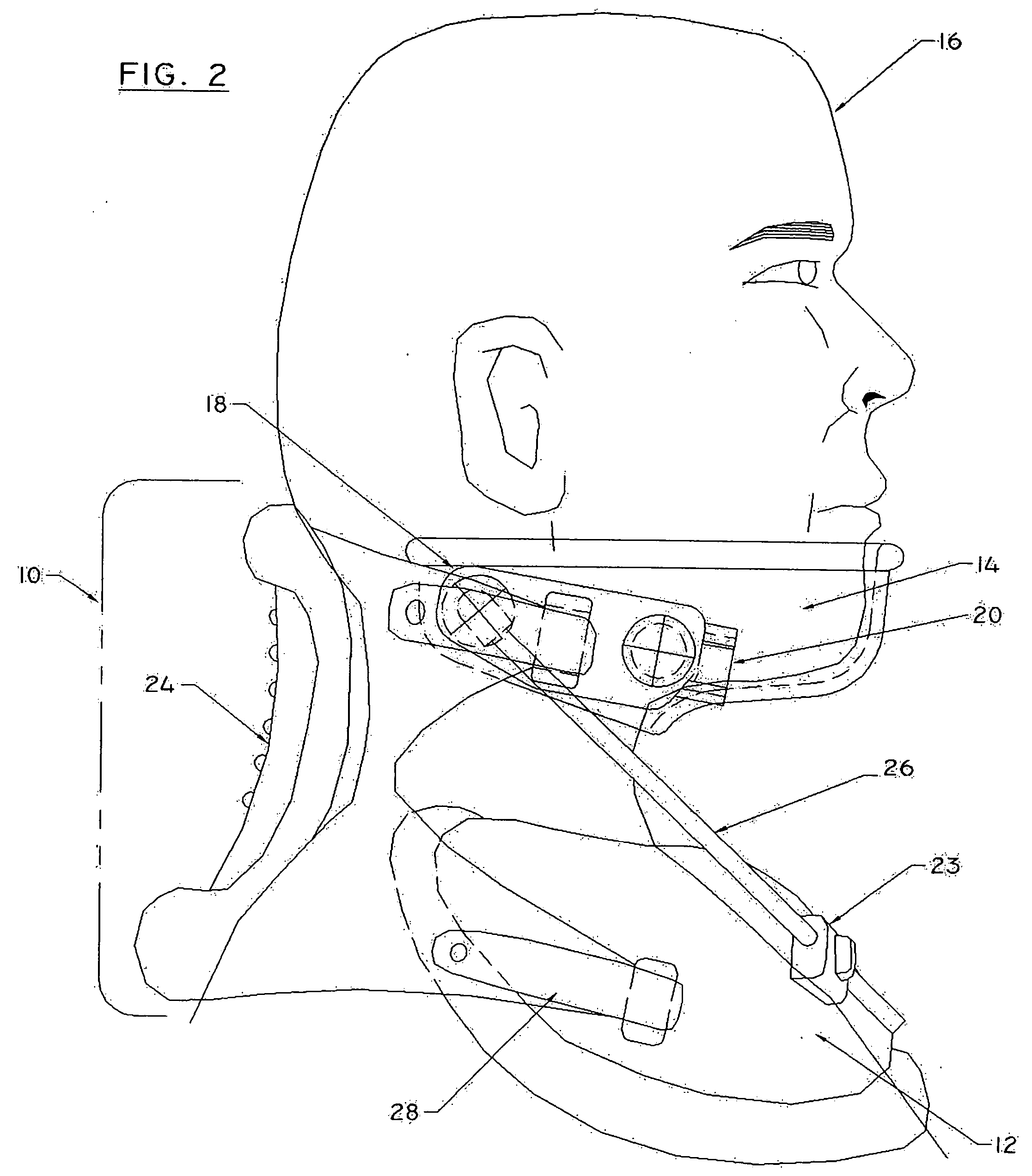 Forward head posture correction collar