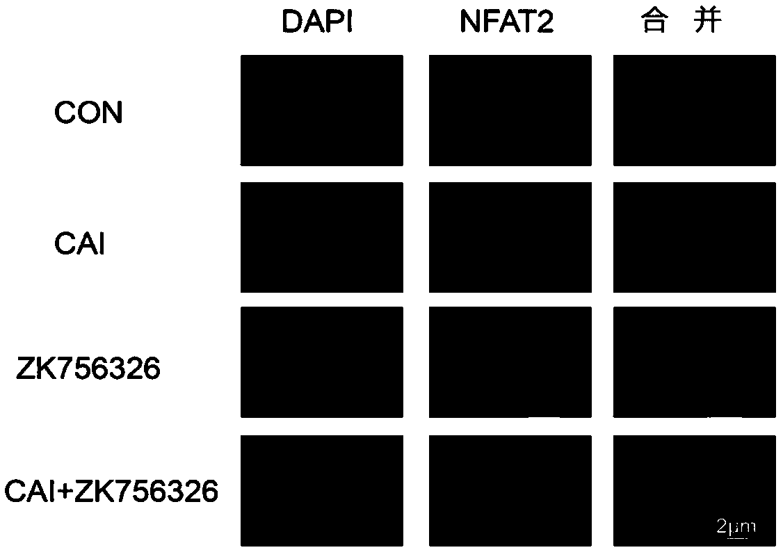 Application of CAI (Carboxyamidotriazole) and IDO1 (Indoleamine 2,3-Dioxygenase) inhibitor combination in resisting tumor