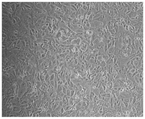 A kind of human endometrial cancer cell line and its establishment method