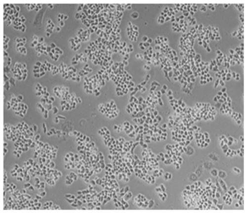 A kind of human endometrial cancer cell line and its establishment method