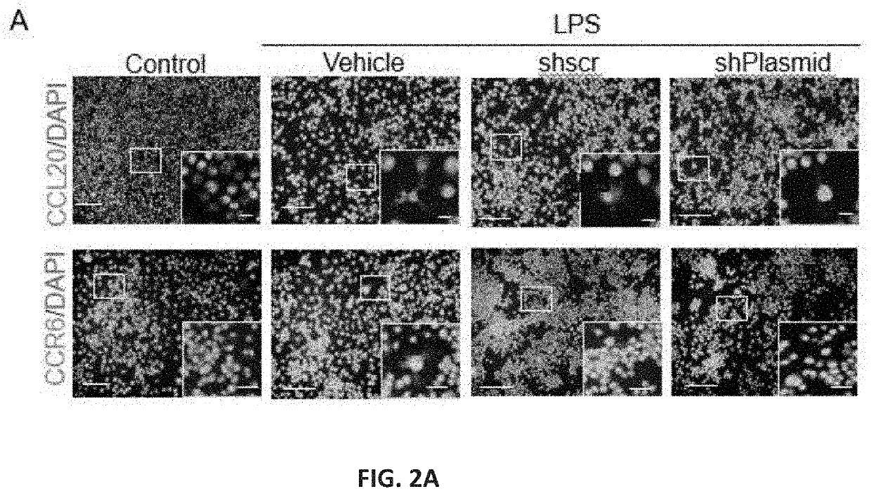 Methods of downregulating ccl20 genes for treatment of traumatic brain injuries