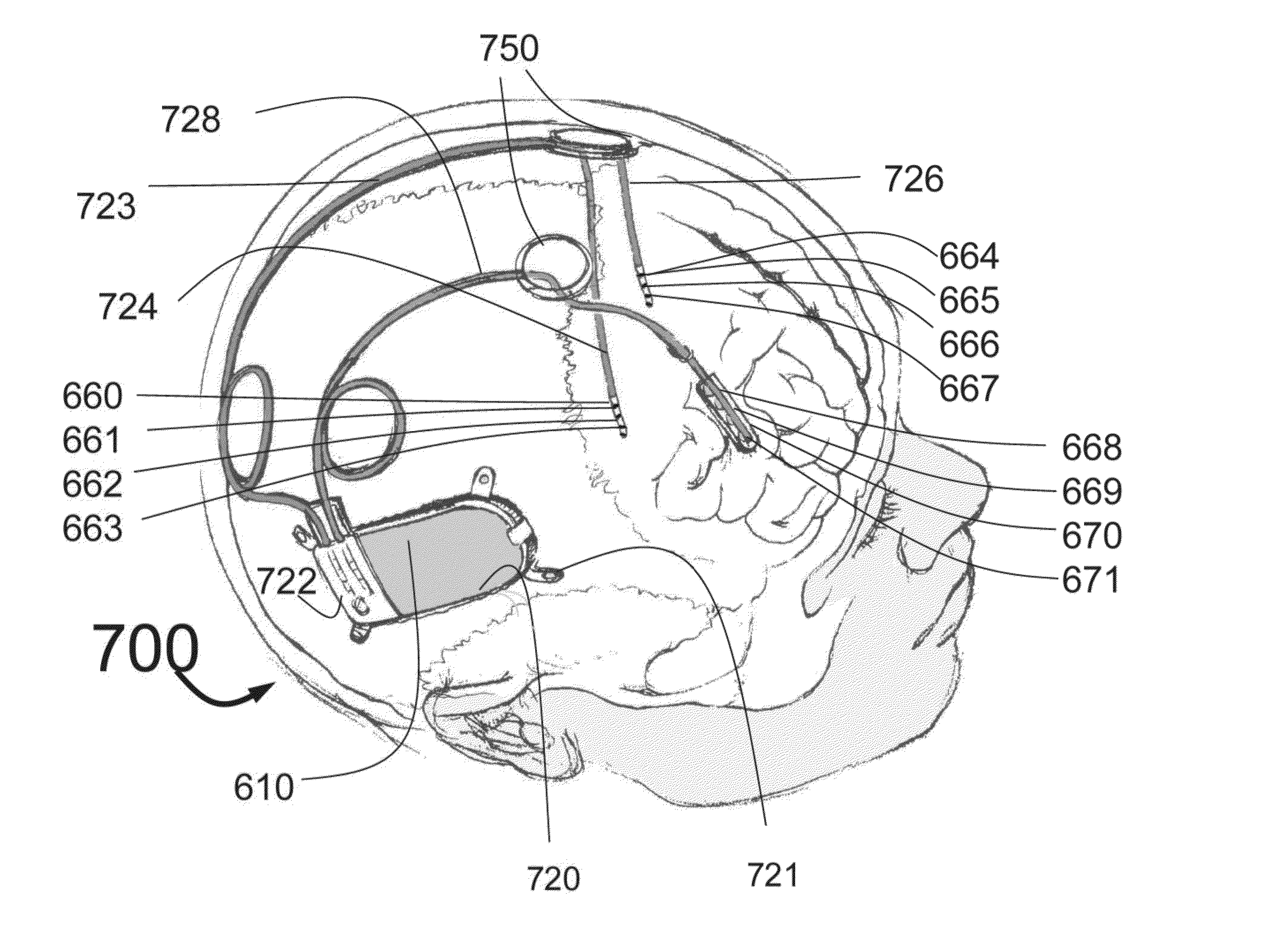 Systems and methods for applying rapid sequential electrode stimulation