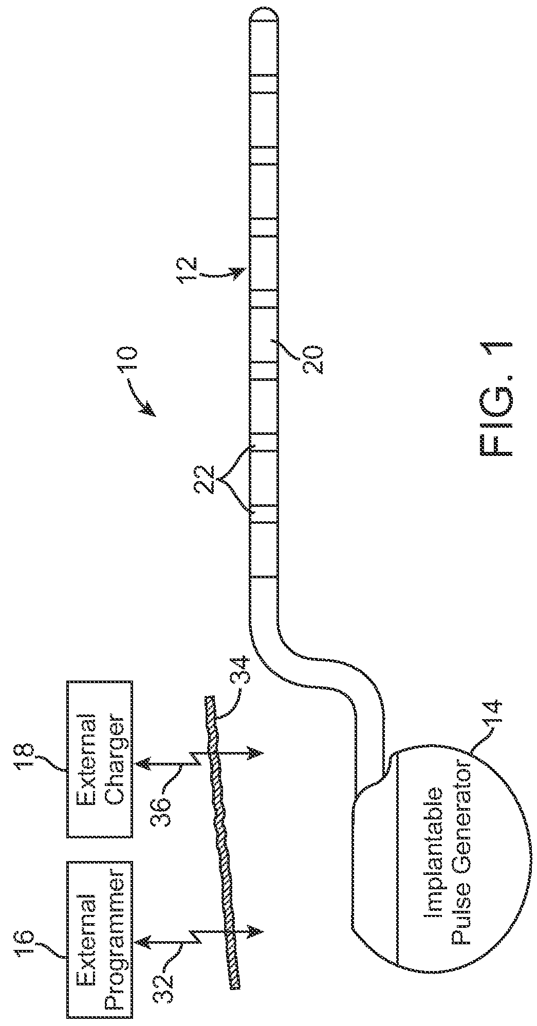 External charger with adjustable alignment indicator