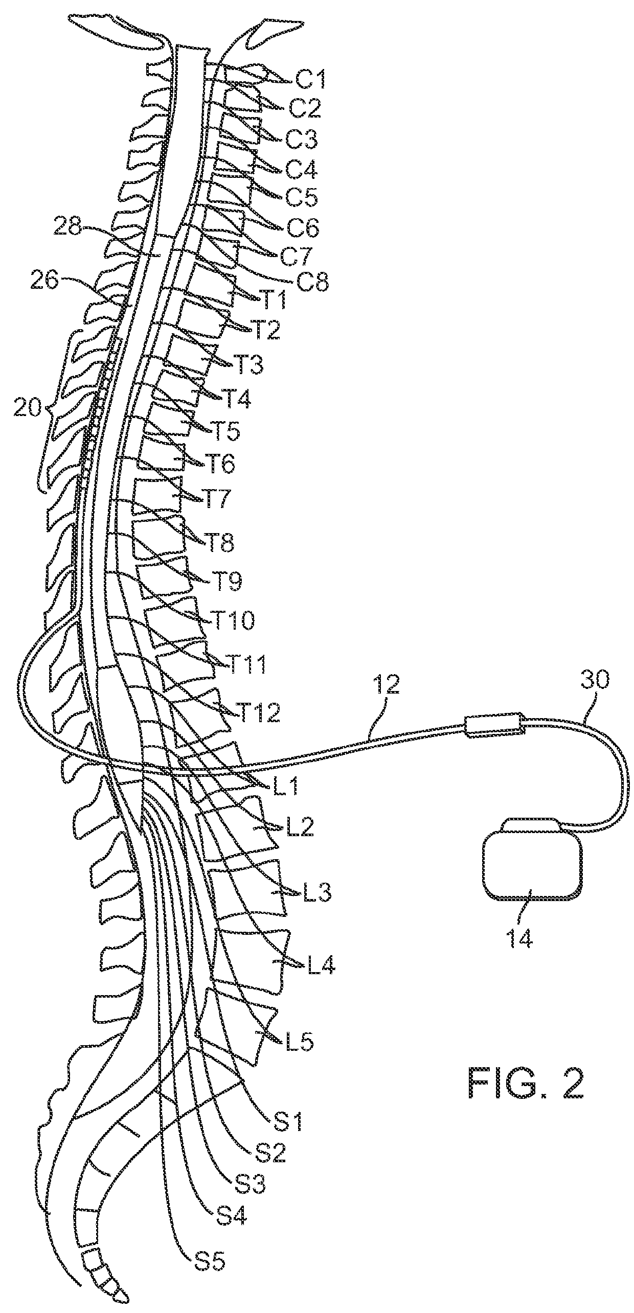 External charger with adjustable alignment indicator