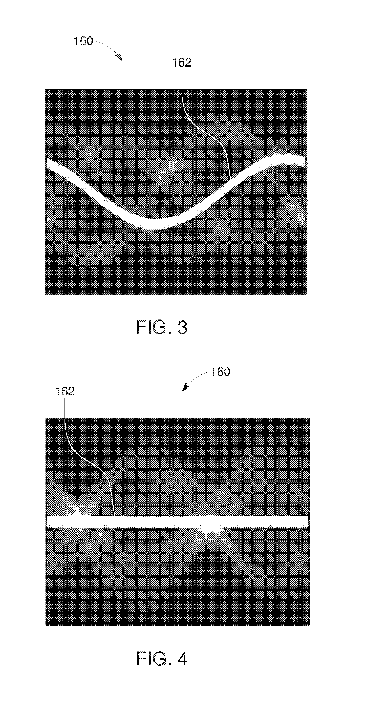 Deep learning based estimation of data for use in tomographic reconstruction