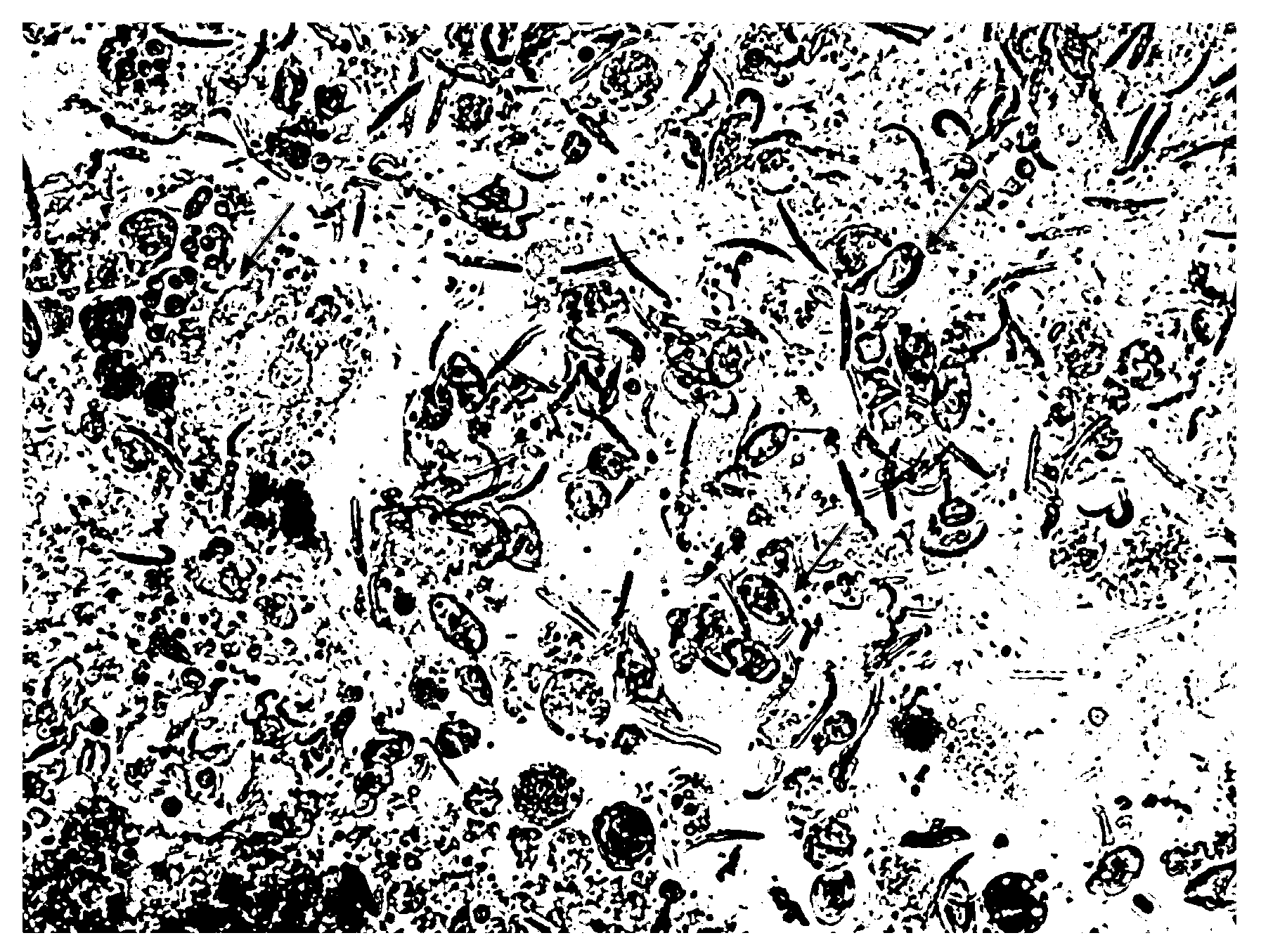 Method for extracting and purifying eimeria tenella merozoite