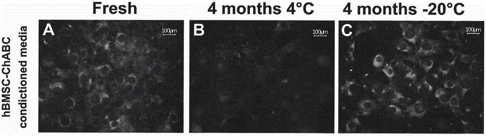 Preparation method of human stem cell for continuously secreting active chondroitinase ABC, kit and clinical use of human stem cell