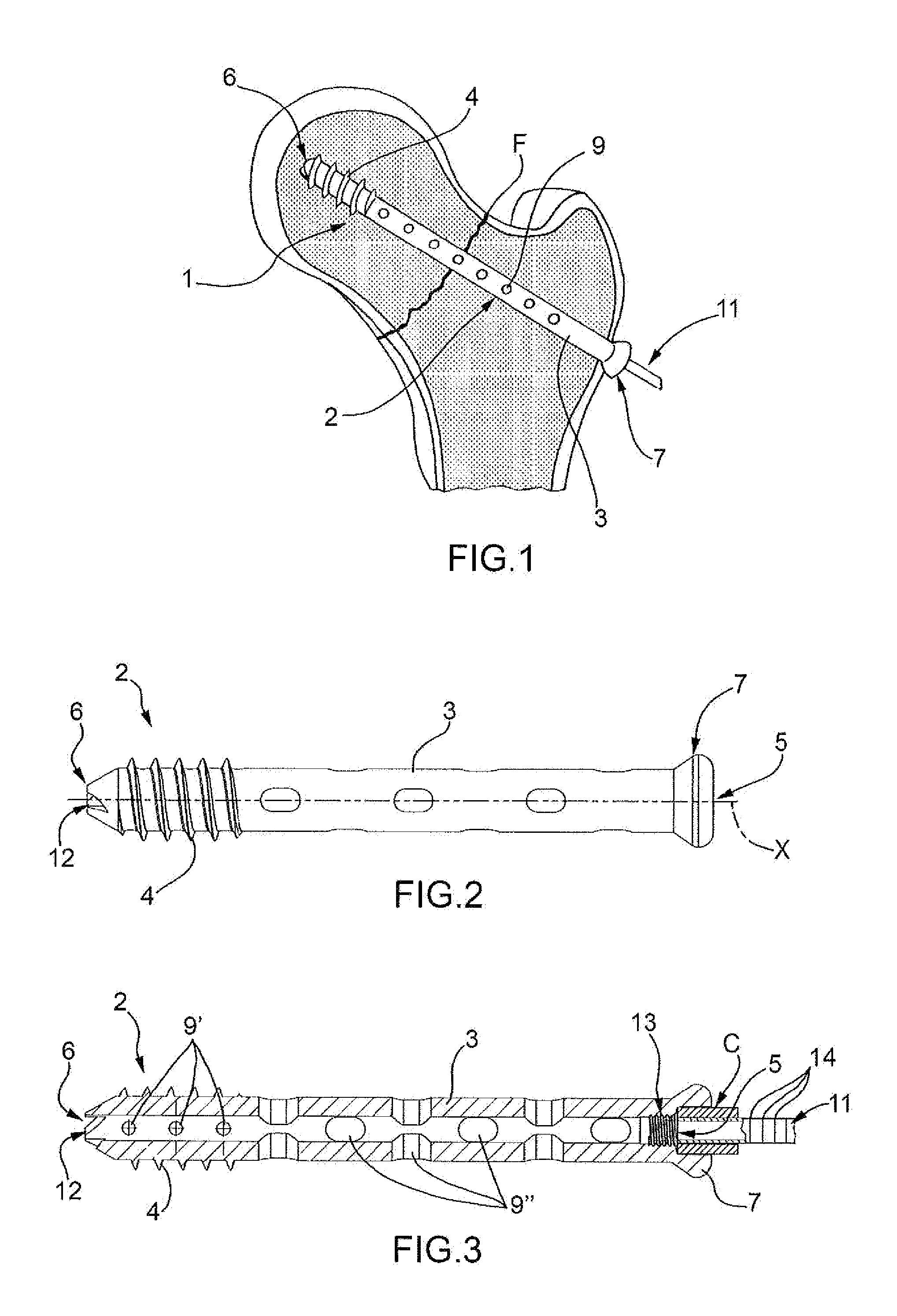 Device for selective biological synthesis of a bone tissue