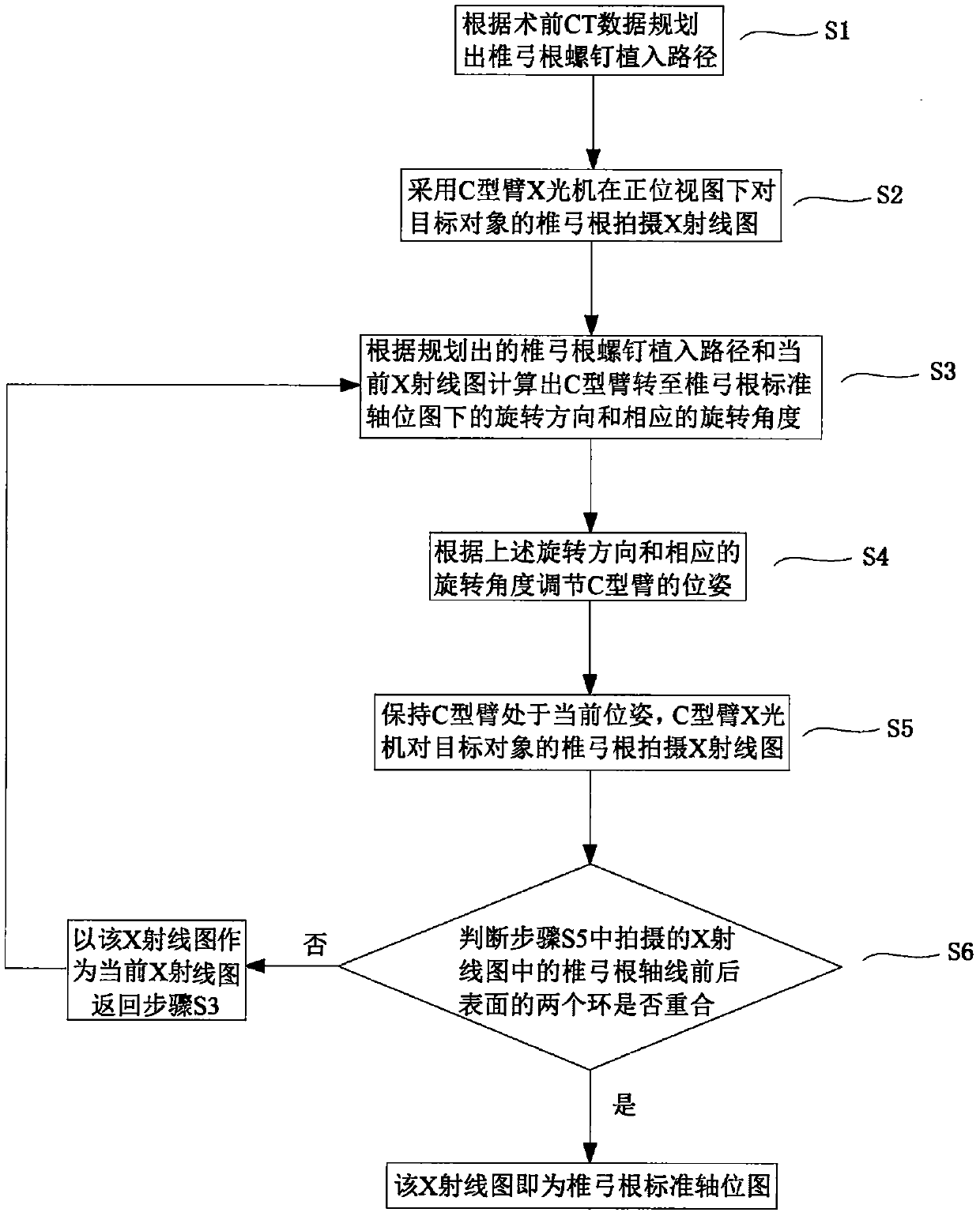 A Method of Obtaining Standard Axial Diagram of Vertebral Pedicle